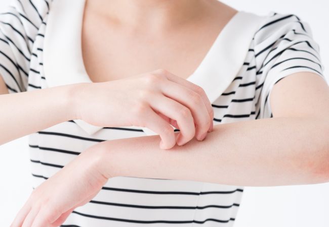 腕をかく女性